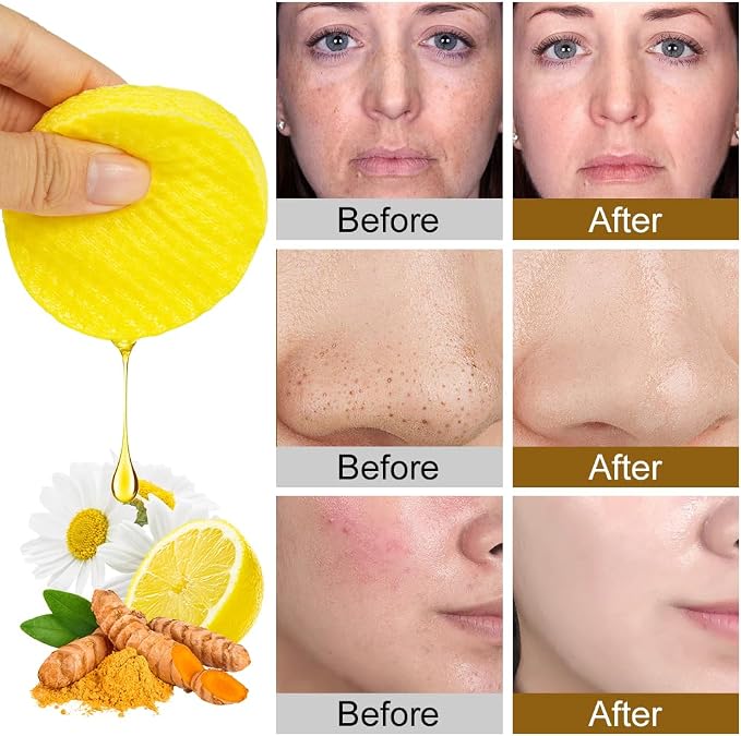 Aomig Turmeric Acid Cleansing Pads 50 sztuk płatków - obrazek 5