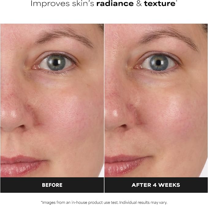 Paula's Choice SKIN BALANCING Tonik - obrazek 7