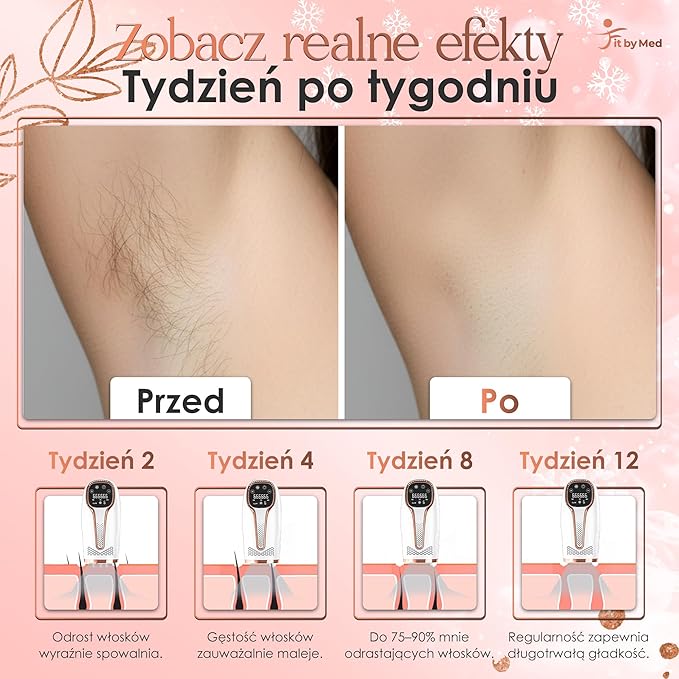 Depilator IPL z Chłodzeniem Ice Cool - obrazek 7